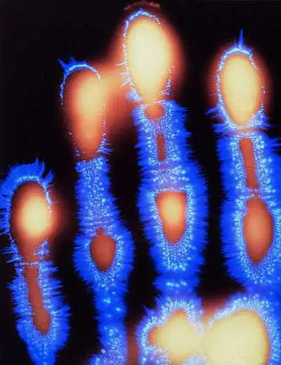 Kirlian photo of a hand